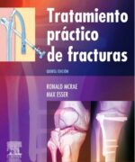 Tratamiento Práctico de Fracturas - Ronald McRae
